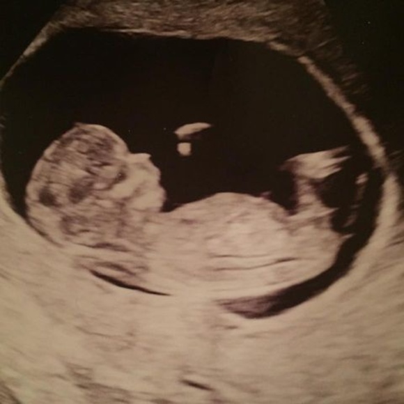 Meet your Posher, Juana - Picture 1 of 1